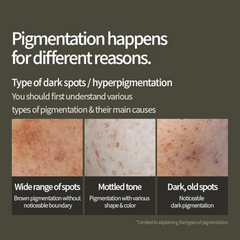 Anua Green Lemon Vitamin C Serum with Vitamin E, Hyaluronic & Ferulic Acid 0.67 fl.oz / 20ml