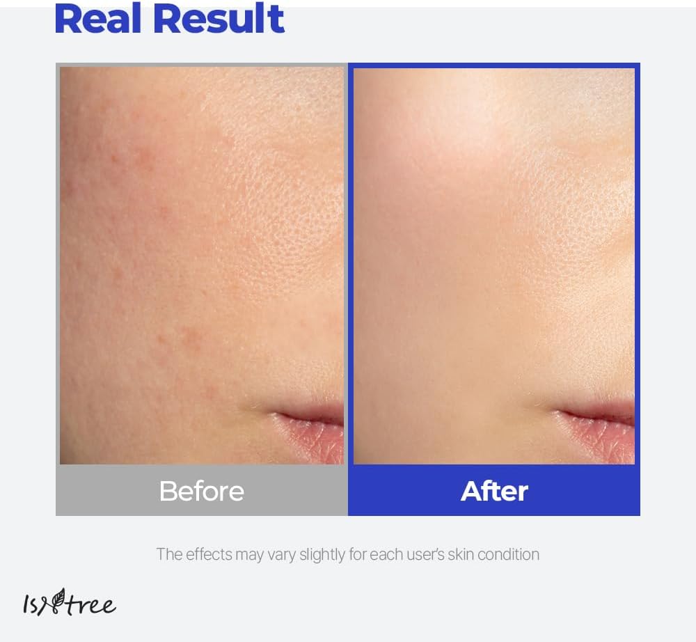 ISNTREE Hyaluronic Acid Aqua Gel Cream 2.71 fl.oz. (80ml) Night Cream, Day Cream, Deep Moisturizing, Skin Protection, Sebum Control, Smoothing |