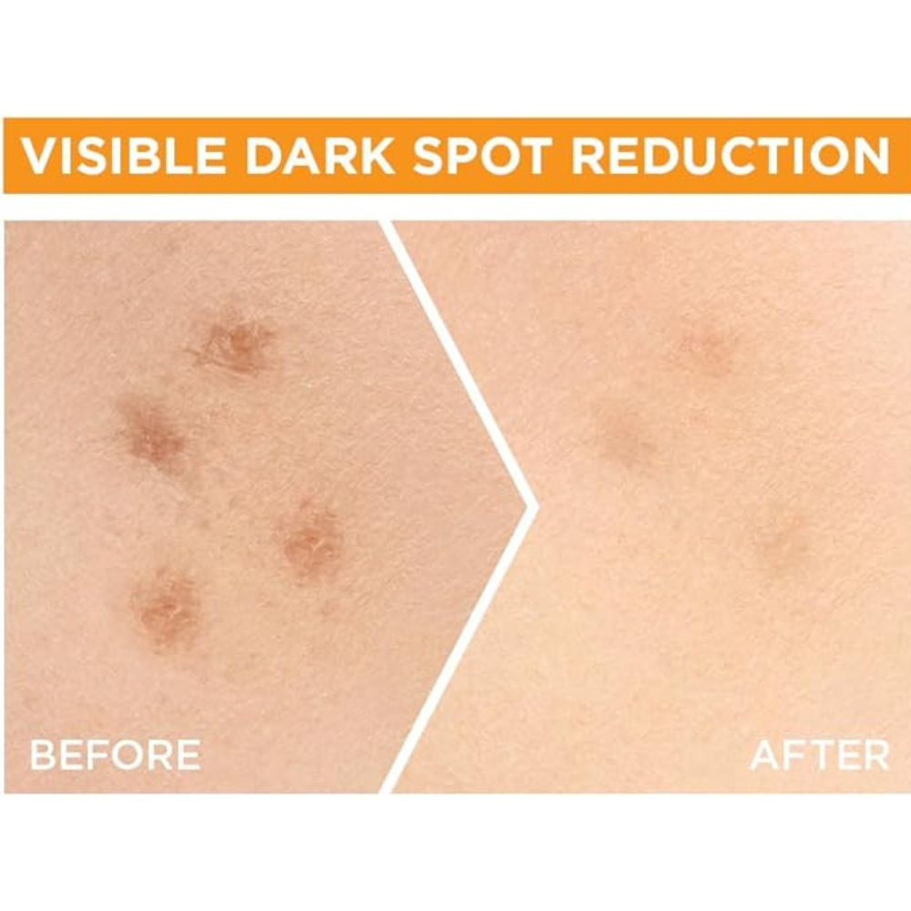 Garnier Skinactive Fast Bright 30X Vitamin C Anti Dark Spot Serum, 30 Ml